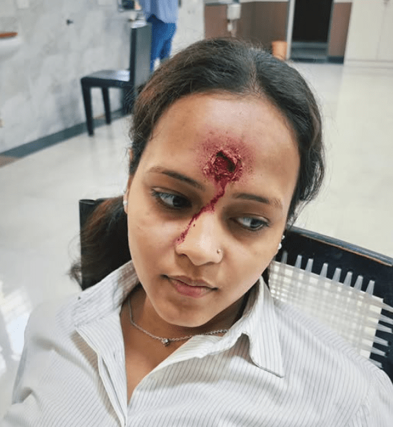 Sfx Makeup